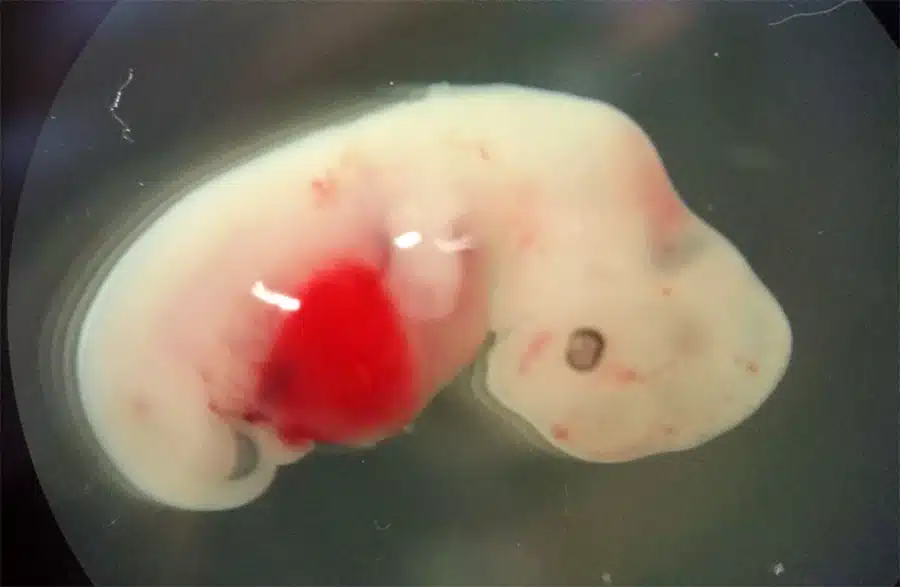 human pig hybrid embryo